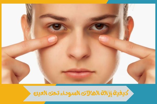 كيفية إزالة الهالات السوداء تحت العين في أسرع وقت 