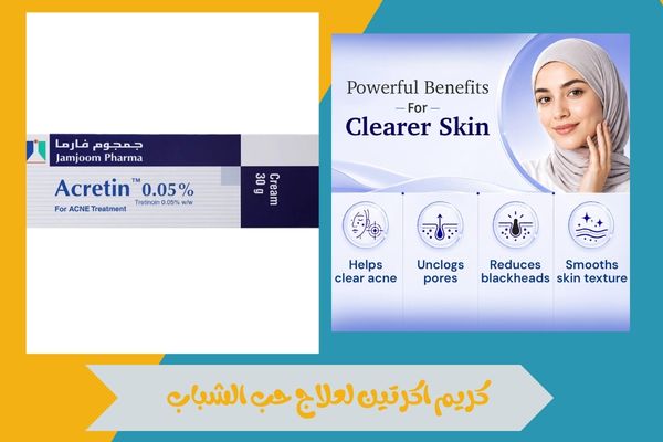 متى تظهر نتائج كريم اكرتين