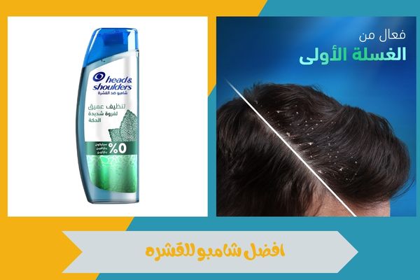 افضل شامبو للقشره