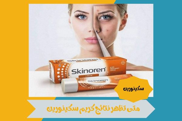 متى تظهر نتائج كريم سكينورين